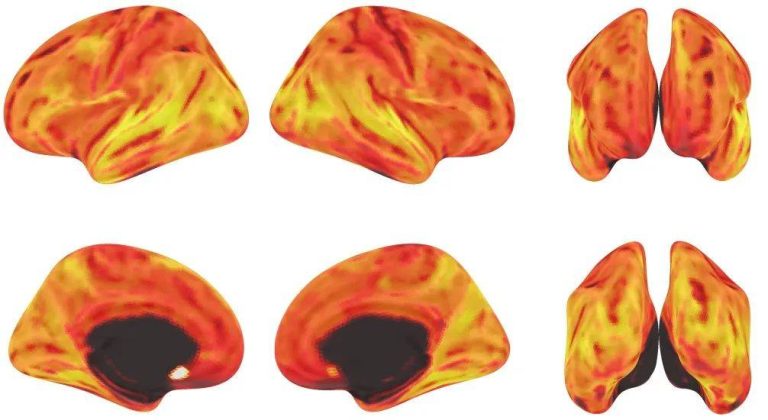 多模态大脑建模技术迈入新纪元：Meta 10亿参数模型获Algonauts 2025大脑建模竞赛冠军